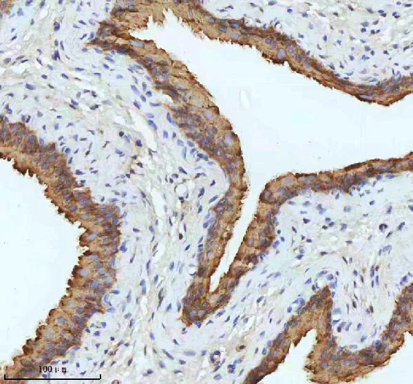 2 - Anti-Cytokeratin 18 Krt18 Rabbit Monoclonal Antibody ABO14193