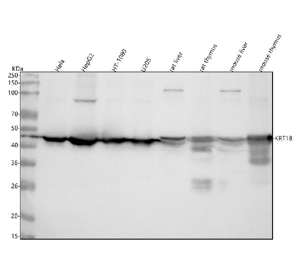 1 - Anti-Cytokeratin 18 Krt18 Rabbit Monoclonal Antibody ABO14193