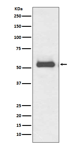 1 - Anti-TRK fused gene TFG Rabbit Monoclonal Antibody ABO14194