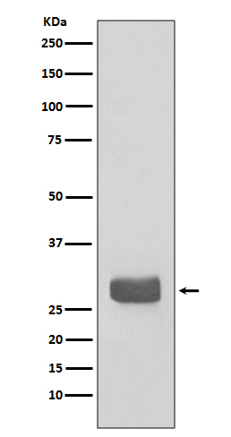 1 - Anti-14-3-3 epsilon YWHAE Rabbit Monoclonal Antibody ABO14195