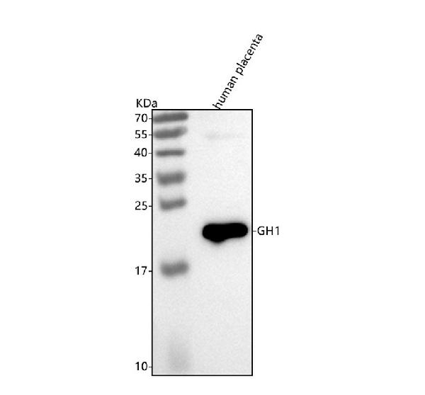 1 - Anti-Growth Hormone GH1 Rabbit Monoclonal Antibody ABO14198