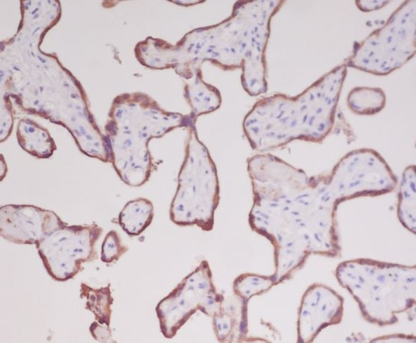 2 - Anti-Growth Hormone GH1 Rabbit Monoclonal Antibody ABO14198