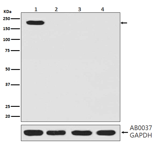1 - Anti-CRISPR-Cas9 SP Rabbit Monoclonal Antibody ABO14199