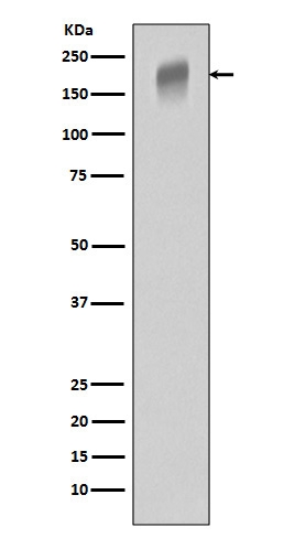 1 - Anti-VEGF Receptor 1 FLT1 Rabbit Monoclonal Antibody ABO14200