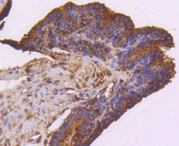 2 - Anti-VEGF Receptor 1 FLT1 Rabbit Monoclonal Antibody ABO14200