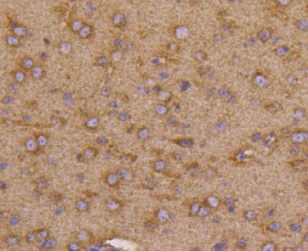 2 - Anti-VEGF Receptor 1 FLT1 Rabbit Monoclonal Antibody ABO14200