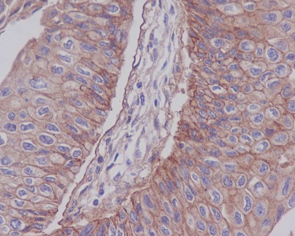 2 - Anti-Integrin beta 1 ITGB1 Rabbit Monoclonal Antibody ABO14201