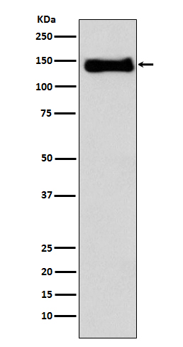 1 - Anti-Integrin beta 1 ITGB1 Rabbit Monoclonal Antibody ABO14201