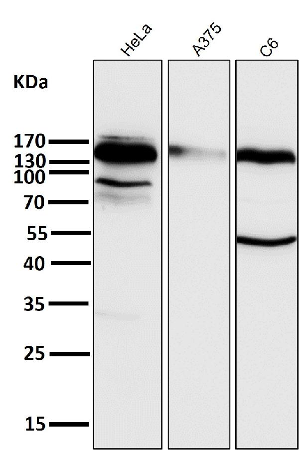1 - Anti-Integrin beta 1 ITGB1 Rabbit Monoclonal Antibody ABO14201