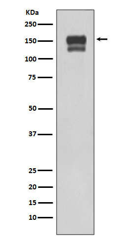 1 - Anti-Integrin beta 1 ITGB1 Rabbit Monoclonal Antibody ABO14202