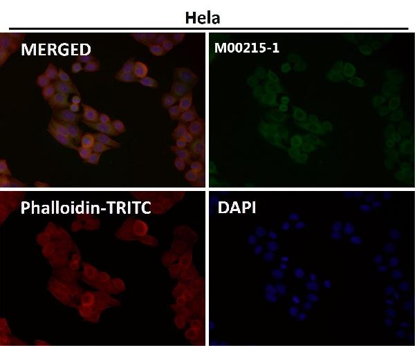 1 - Anti-Alpha Synuclein SNCA Rabbit Monoclonal Antibody ABO14203