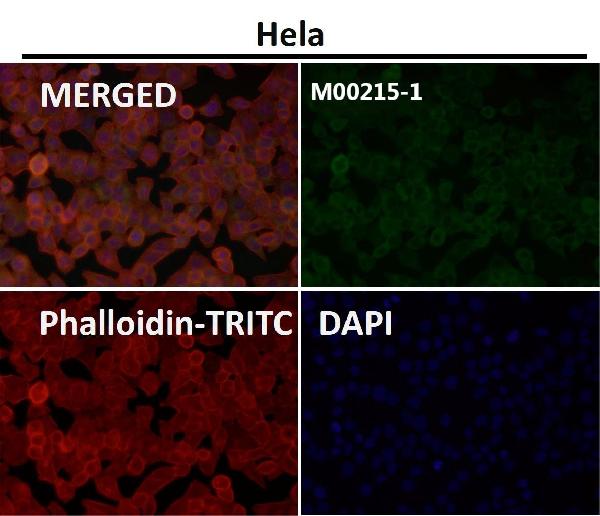 1 - Anti-Alpha Synuclein SNCA Rabbit Monoclonal Antibody ABO14203