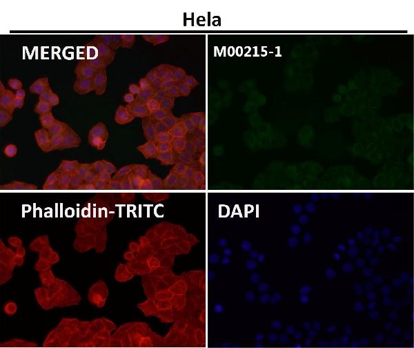 1 - Anti-Alpha Synuclein SNCA Rabbit Monoclonal Antibody ABO14203