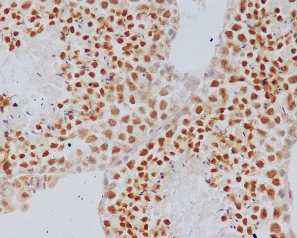 2 - Anti-Alpha Synuclein SNCA Rabbit Monoclonal Antibody ABO14203