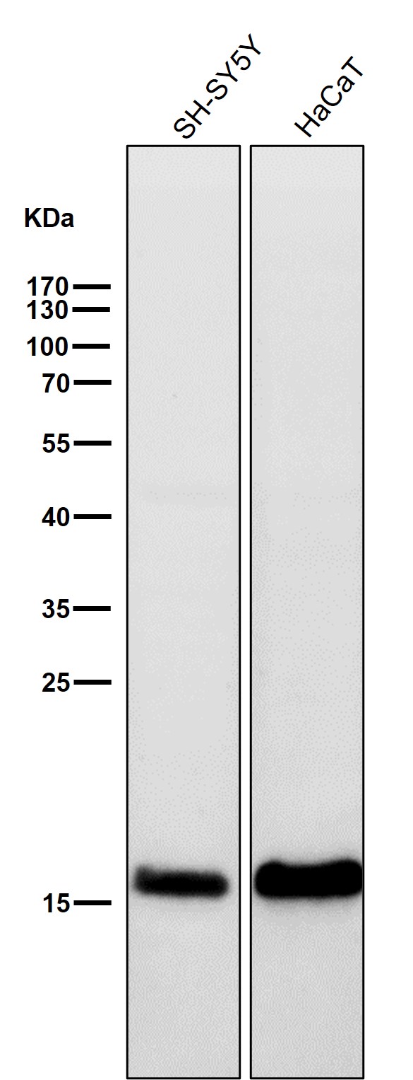 1 - Anti-Alpha Synuclein SNCA Rabbit Monoclonal Antibody ABO14203