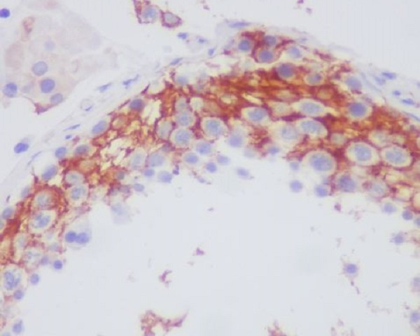 2 - Anti-Integrin beta 3 ITGB3 Rabbit Monoclonal Antibody ABO14204