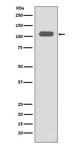 1 - Anti-Integrin beta 3 ITGB3 Rabbit Monoclonal Antibody ABO14204