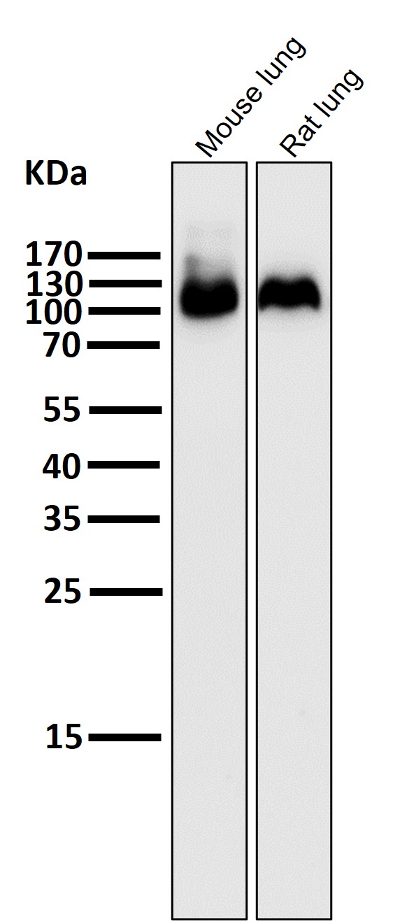 1 - Anti-Integrin beta 3 ITGB3 Rabbit Monoclonal Antibody ABO14204