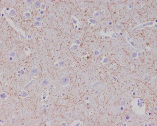 2 - Anti-Amyloid beta A4 APP Rabbit Monoclonal Antibody ABO14205