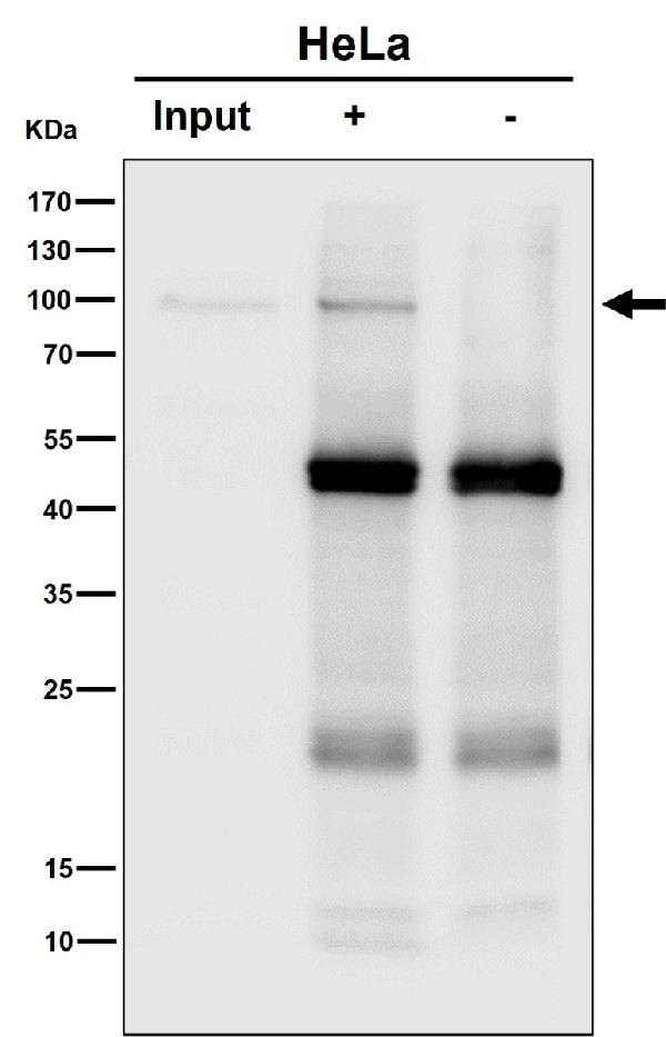 1 - Anti-Amyloid beta A4 APP Rabbit Monoclonal Antibody ABO14205