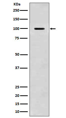 1 - Anti-Amyloid beta A4 APP Rabbit Monoclonal Antibody ABO14205