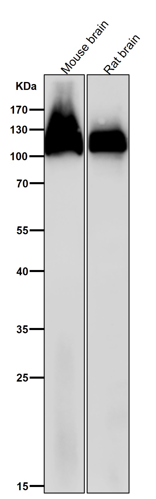1 - Anti-Amyloid beta A4 APP Rabbit Monoclonal Antibody ABO14205