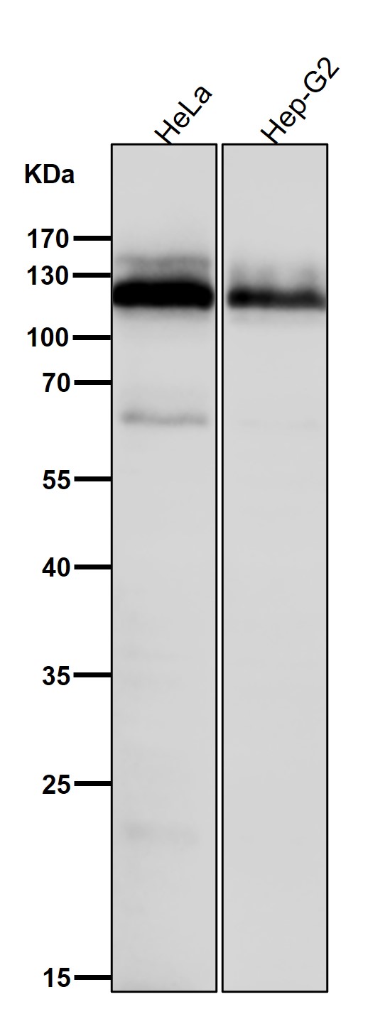 1 - Anti-Amyloid beta A4 APP Rabbit Monoclonal Antibody ABO14205