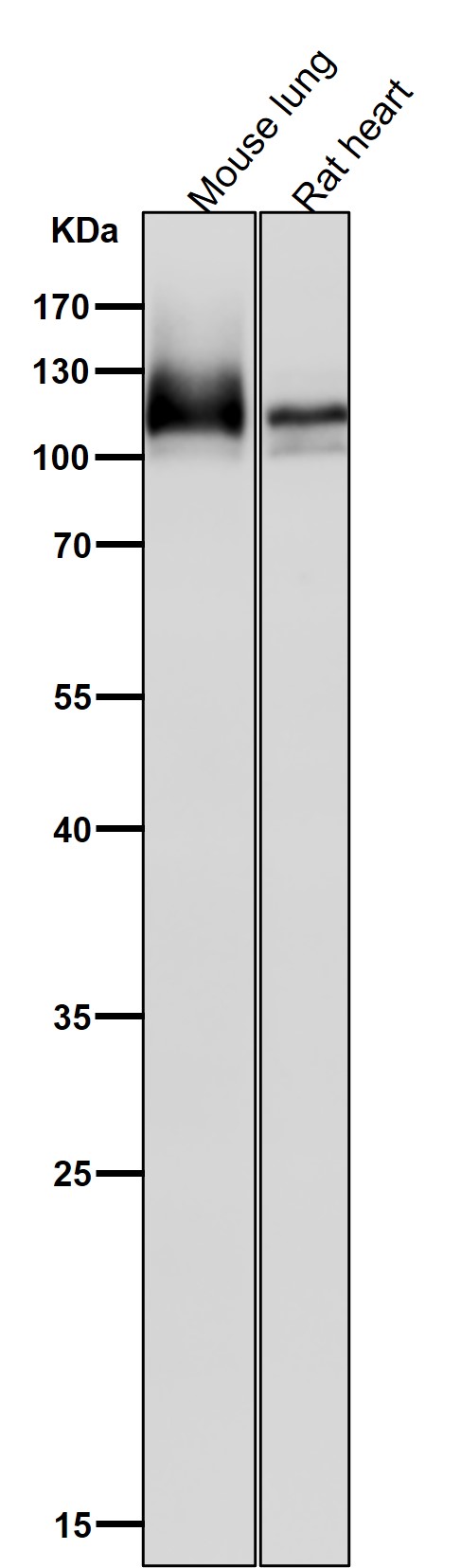 1 - Anti-Amyloid beta A4 APP Rabbit Monoclonal Antibody ABO14205