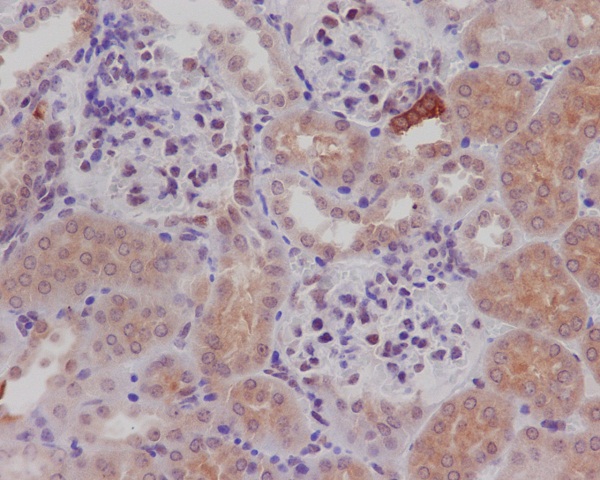 2 - Anti-nNOS (neuronal) NOS1 Rabbit Monoclonal Antibody ABO14206