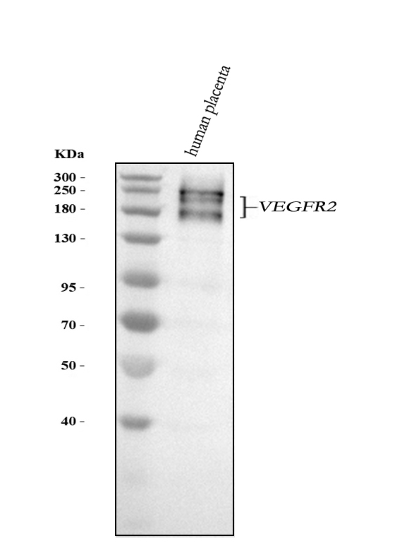 1 - Anti-VEGF Receptor 2 KDR Rabbit Monoclonal Antibody ABO14207