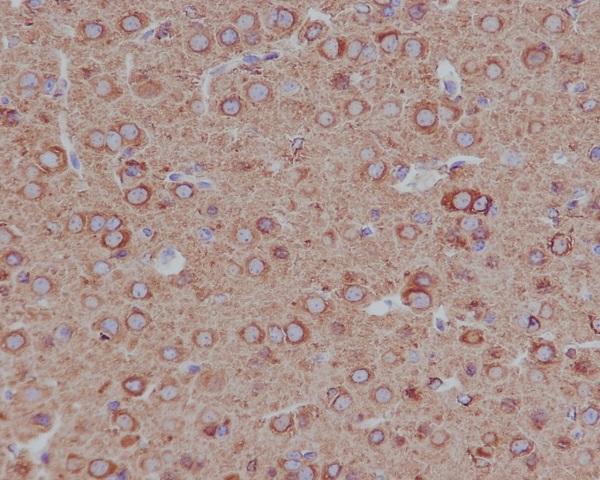 2 - Anti-beta II Tubulin Rabbit Monoclonal Antibody ABO14208
