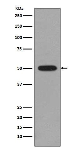 1 - Anti-beta II Tubulin Rabbit Monoclonal Antibody ABO14208