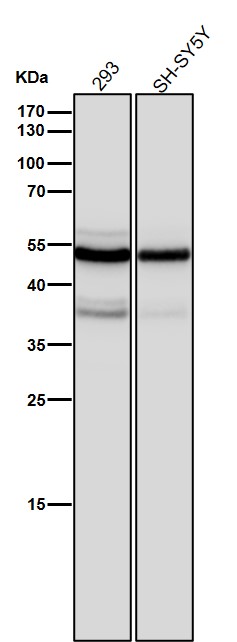 1 - Anti-beta II Tubulin Rabbit Monoclonal Antibody ABO14208