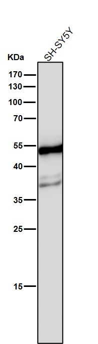 1 - Anti-beta II Tubulin Rabbit Monoclonal Antibody ABO14208