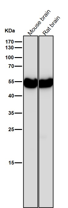 1 - Anti-beta II Tubulin Rabbit Monoclonal Antibody ABO14208