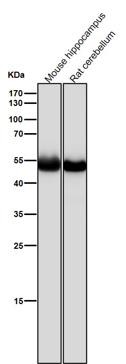 1 - Anti-beta II Tubulin Rabbit Monoclonal Antibody ABO14208