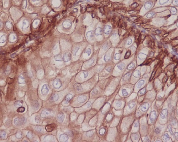 2 - Anti-Integrin beta 1 ITGB1 Rabbit Monoclonal Antibody ABO14209