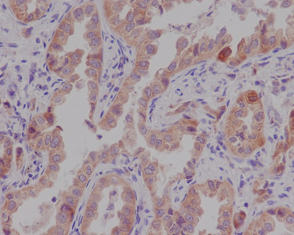 2 - Anti-Catenin alpha 1 CTNNA1 Rabbit Monoclonal Antibody ABO14210