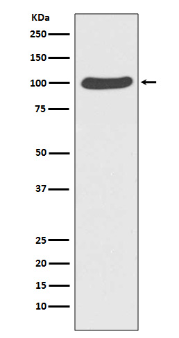 1 - Anti-Catenin alpha 1 CTNNA1 Rabbit Monoclonal Antibody ABO14210