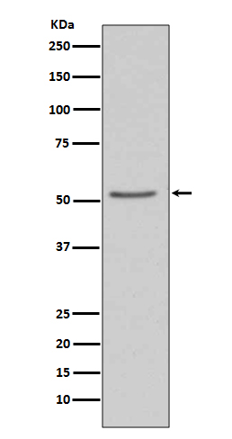 1 - Anti-Angiotensinogen AGT Rabbit Monoclonal Antibody ABO14211