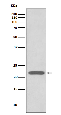 1 - Anti-Peroxiredoxin 2 Rabbit Monoclonal Antibody ABO14212