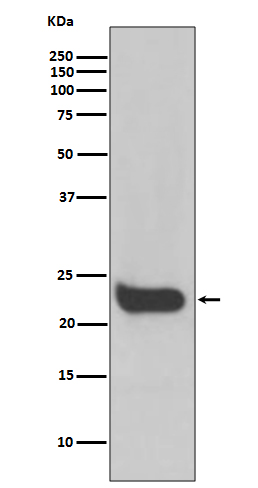 1 - Anti-Interferon beta Rabbit Monoclonal Antibody ABO14214