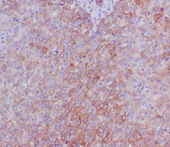 2 - Anti-Integrin beta 4 ITGB4 Rabbit Monoclonal Antibody ABO14215
