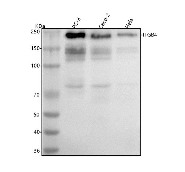 1 - Anti-Integrin beta 4 ITGB4 Rabbit Monoclonal Antibody ABO14215