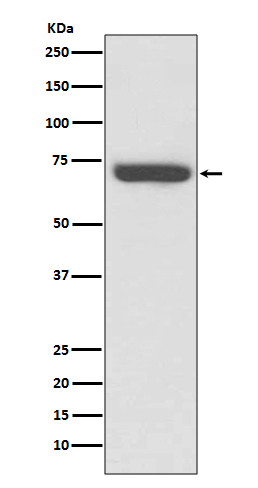 1 - Anti-TNF Receptor II TNFRSF1B Rabbit Monoclonal Antibody ABO14216
