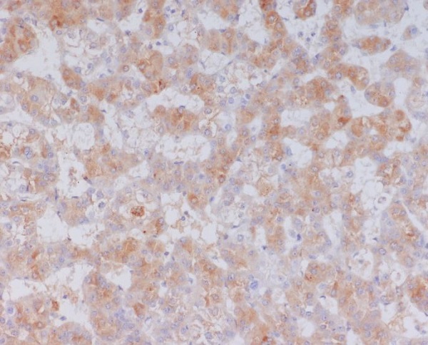 2 - Anti-Serum Amyloid A SAA1 Rabbit Monoclonal Antibody ABO14217