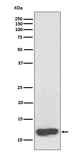 1 - Anti-Serum Amyloid A SAA1 Rabbit Monoclonal Antibody ABO14217