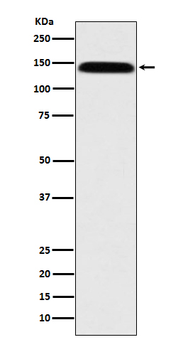 1 - Anti-Leptin Receptor LEPR Rabbit Monoclonal Antibody ABO14218