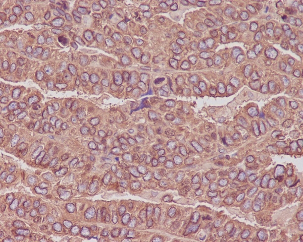 2 - Anti-beta III Tubulin TUBB3 Rabbit Monoclonal Antibody ABO14219