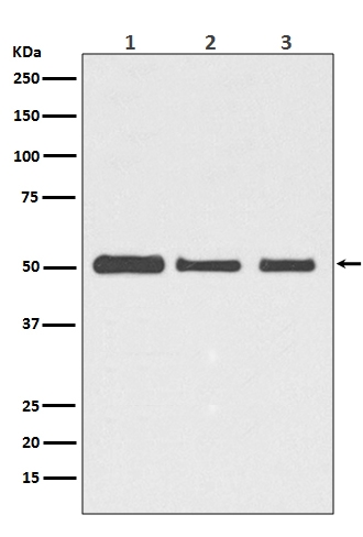 1 - Anti-beta III Tubulin TUBB3 Rabbit Monoclonal Antibody ABO14219